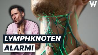 Unbekannte Knubbel Gefährlich von harmlos unterscheiden Wichtigsten Fakten zu großen Lymphknoten [upl. by April]