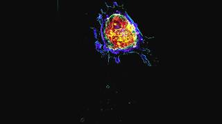 Apoptosis Programmed Cell Death  Live and in 3D [upl. by Baal]