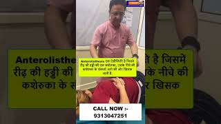 Anterolisthesis  Chiropractic Treatment in Delhi  Dr Varun  Call  9313047251 delhi noida [upl. by Demeyer]