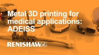 Metal 3D printing for medical applications ADEISS [upl. by Janenna]