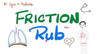 Friction Rub  Pericarditis Pleurisy Pleuritis  Signs in Medicine [upl. by Bobbye27]