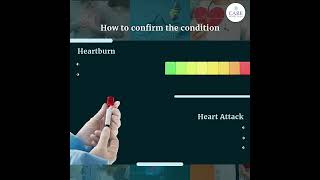 Heart Burn Vs Heart Attack  Signs and Symptoms  CARE Hospitals [upl. by Chura143]