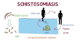 Schistosomiasis Bilharzia– an overview [upl. by Sandry440]