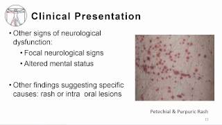 1 Overview meningitis and encephalitis [upl. by Acile]