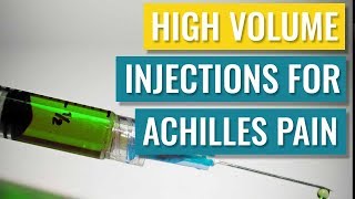 HighVolume Injections for Achilles Tendinopathy [upl. by Woodberry]