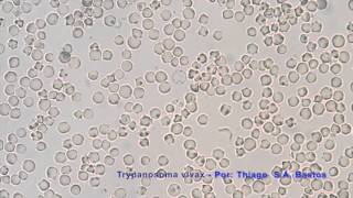 Trypanosoma vivax [upl. by Letha560]