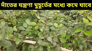 দাঁতের যন্ত্রণা থেকে মুক্তির উপায়dater jontrona komanor upayWays to get rid of toothache [upl. by Ahsenet35]