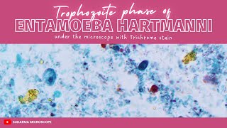 Trophozoite phase of Entamoeba hartmanni under the microscope with Trichrome stain [upl. by Leahey]