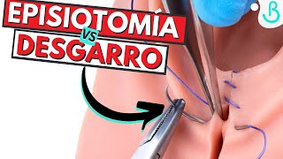 🪡✂️EPISIOTOMÍA VS DESGARRO ¿QUÉ ES MEJOR PARA EL PARTO  Baby Suite by Pau [upl. by Kcirdef]