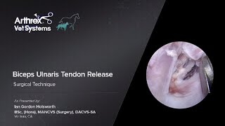 Biceps Ulnaris Tendon Release [upl. by Isaak]