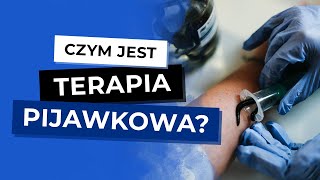 Hirudoterapia  Aplikacja Pijawki Jak postawić pijawkę Czym jest hirudoterapia [upl. by Scuram304]