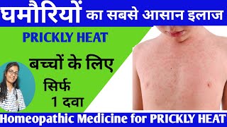 Homeopathic Medicine For Prickly Heat Treatment of Prickly Heat  घमौरियों का अचूक होम्योपैथिक दवा [upl. by Katonah]