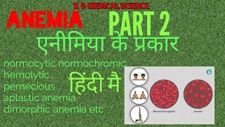 Anemia amp its types simple एक्सप्लनेशन हिंदी ANEMIA PART 2 [upl. by Rouvin520]