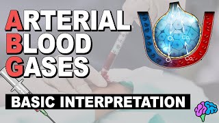 Basic ABG Interpretation  Arterial Blood Gases Part 3 [upl. by Birecree]