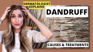 Dermatologist Explains Dandruff What Causes it amp Best Dandruff Treatments  Dr Sam Ellis [upl. by Helyn]