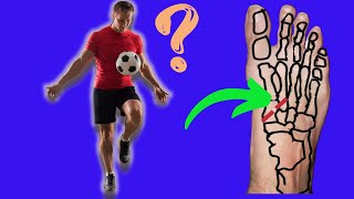 LISFRANC INJURY  When Can I RETURN TO SPORT [upl. by Ardnauqal]