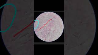 White Fibrocartilage Histology Anatomy 1st year MBBS [upl. by Ablasor]