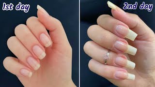 How to grow nails in 2 days  How to grow nails fast  How to grow nails fast overnight [upl. by Irpak584]