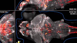 Wholebrain imaging of neuronal activity in a larval zebrafish [upl. by Fu]