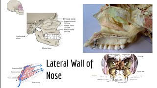 Lateral wall of nasal cavity [upl. by Feld]