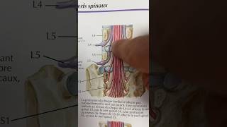 Réponse Quiz sur sténose foraminale  hernie discale [upl. by Cordi]