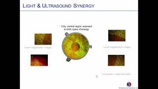 Coincident LightUltrasound Therapy To Treat Bacterial Biofilms [upl. by Zephaniah885]