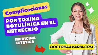 Complicaciones de la Toxina Botulínica en el Entrecejo [upl. by Cesaria]