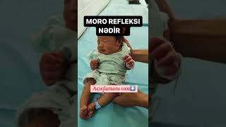 Moro refleksi nedir shorts video viralvideo amu shortsyoutube youtubeshorts youtube [upl. by Teirrah107]