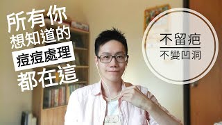 痘痘不留痘疤。全攻略。所有你該知道的都在這了 【Dr Ivan 6】Right Acne Treatment for You 《保養》 [upl. by Herwick611]