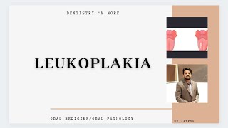 LEUKOPLAKIA [upl. by Eilac]