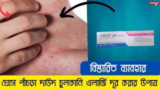 exovate n ointment এর কাজ কি  দাউদ দূর করার উপায়  দাউদ দূর করার বেস্ট ক্রিম [upl. by Nohtahoj]