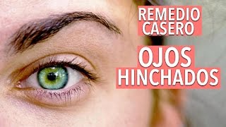 COMO QUITAR LOS OJOS HINCHADOS OJERAS Y BOLSAS EN LOS OJOS  YASMANY [upl. by Yngad]