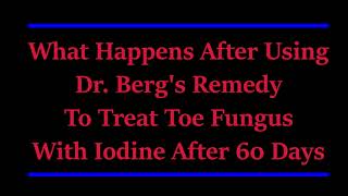 DR ERIC BERGS REMEDY ON TOENAIL FUNGUS IS PUT TO THE TEST FOR 60 DAYS [upl. by Ruddie]