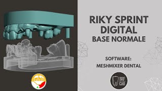 MESHMIXER DENTAL INHIO RIKY SPRINT DIGITAL BASE TUTORIAL INTRAORAL SCAN EXOCAD 3SHAPE [upl. by Jehiah]