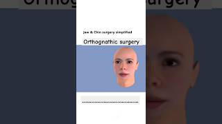 Orthognathic surgery shorts cristiano mbbs femalereproductivesystem [upl. by Edy753]