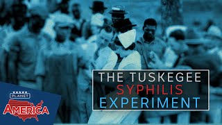 The horrifying ‘experiment’ of Tuskegee  Planet America [upl. by Robbin332]