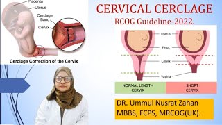 Cervical Cerclage RCOG Guideline2022 [upl. by Florian]