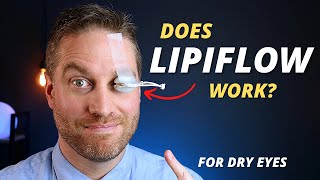 Is Lipiflow Worth It  Advanced Dry Eye Treatment For Meibomian Gland Dysfunction MGD [upl. by Llennej]