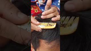 Thousand lice combing  Big lice removal [upl. by Edora]