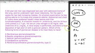 517 MEMBRANOUS GLOMERULONEPHRITIS [upl. by Baalbeer751]