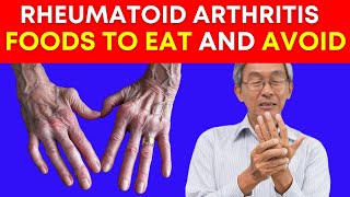 Ultimate Guide to Rheumatoid Arthritis Diet Foods to Eat and Avoid [upl. by Ratep]