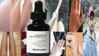 Minimalist Rosehip Oil  VC  IP Vitamin C 100 Face Serum  Honest Review [upl. by Enilehcim]