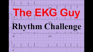 EKGECG  Rhythm Challenge 120  The EKG Guy [upl. by Plath150]