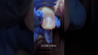 Cute nails satisfying pedicure nails pedicure satisfying [upl. by Mathews]