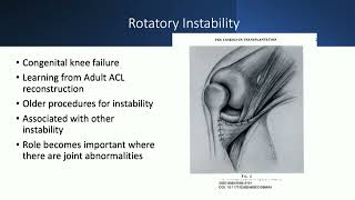 Hypoplasia of femoral condyle approach amp management  N Nicolaou [upl. by Siari]