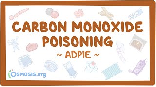 Carbon monoxide poisoning Nursing Process ADPIE [upl. by Orsino46]