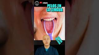 🔴PELOS en la LENGUA shorts lenguavellosa [upl. by Darwin234]