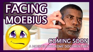 Facing Moebius Trailer  A Moebius Syndrome Documentary [upl. by Ayrb]