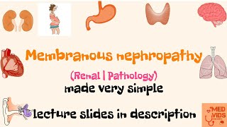 Membranous nephropathy  Renal  Pathology  Med Vids made simple [upl. by Camellia]