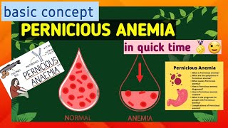 Pernicious anemia  what is anemia  cause  symptoms  treatment [upl. by Ajnotal]